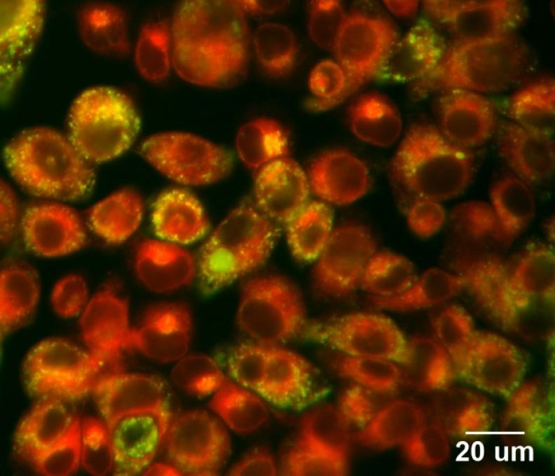 Photosensitizer accumulated in NPC cells with lysosome probe (Green)