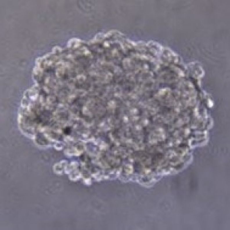 Pancreatic pseudoislet spheroid generated during 3D culture of clonal 1.1B4 pancreatic beta cells