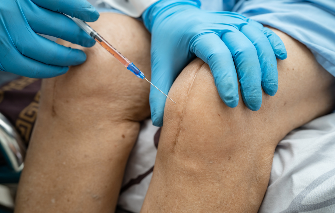 Stem cell trials for tendon injuries research