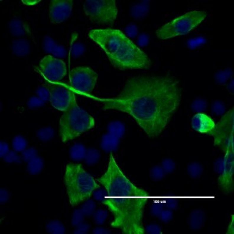 Cellular detection of ductal marker, cytokeratin-19 (green) by immunofluorescence in PANC-1 human pancreatic adenocarcinoma cells